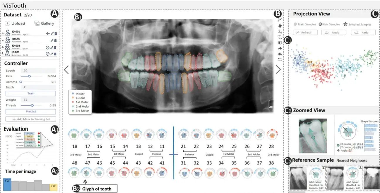 Figure of ViSTooth paper