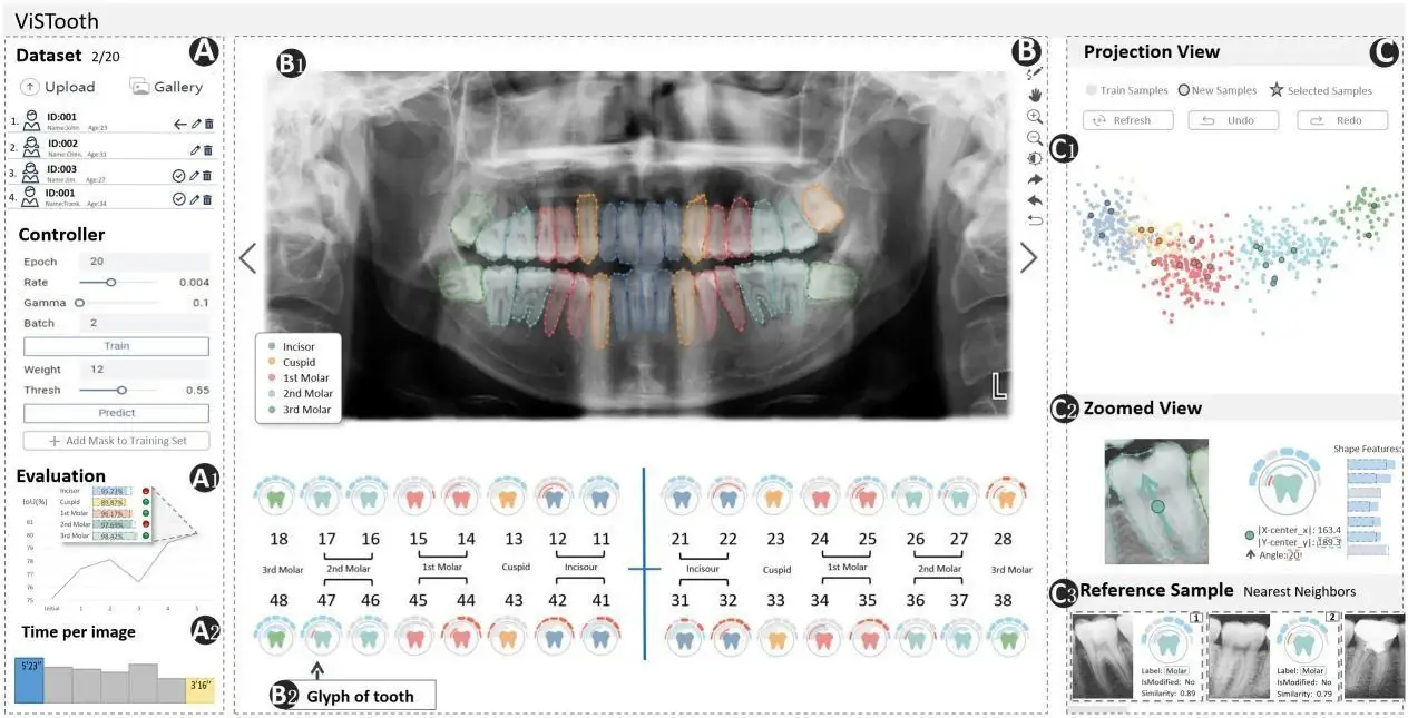 Figure from the patent on human-machine tooth segmentation based on deep learning